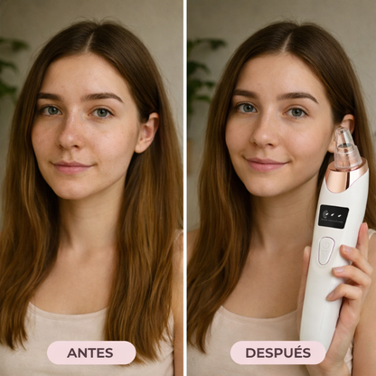 ZENVAK™ – Piel Limpia. Poros Visibles No Más.